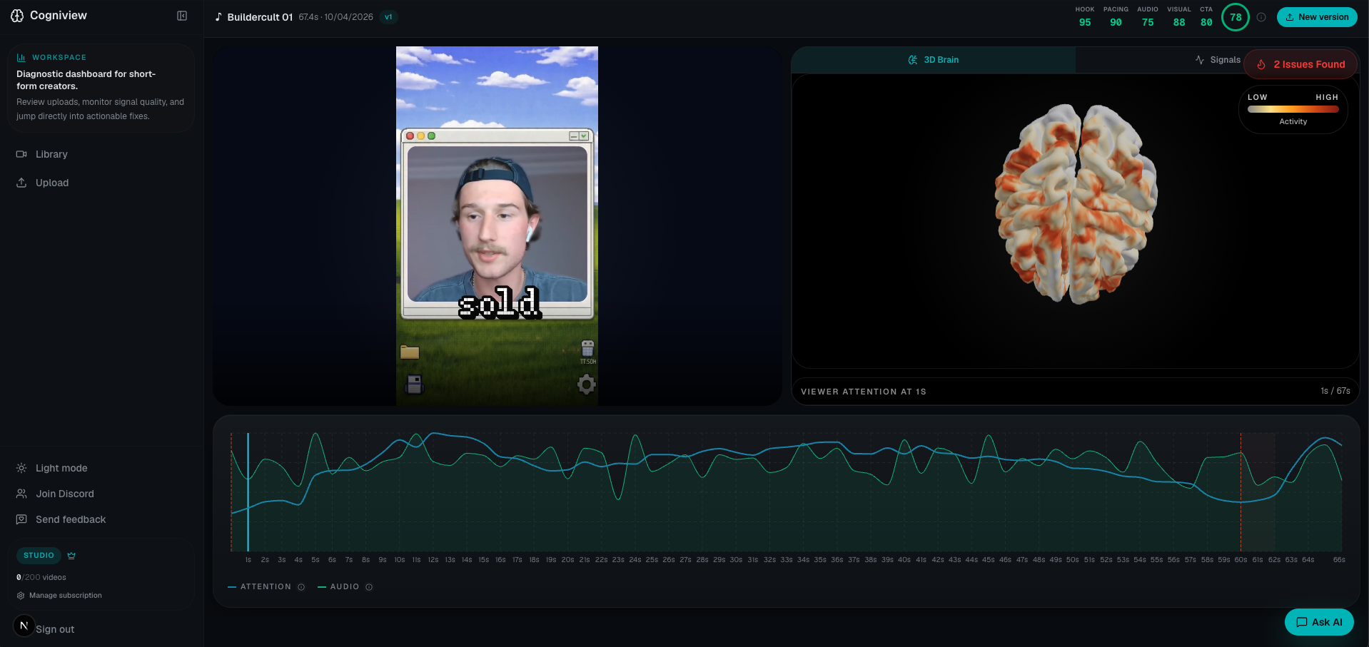 Cogniview dashboard showing a video report with brain activity, signal timeline, and issue detection